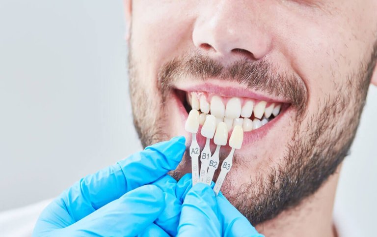 The Rise of Dental Implants in Las Vegas: A Comprehensive Guide
